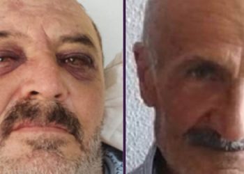 AKP’li vekil Servet Turgut’un nasıl öldürüldüğüne cevap veremedi