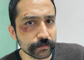 Avukat Aytaç Ünsal’a gözaltında işkence