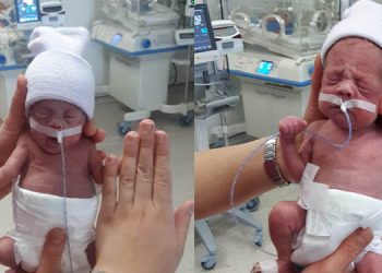 490 gram ve 680 gram doğan ikizler hayata tutundu