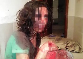 İşkenceci kocanın pişkin savunması: Kendi kendine yapmıştır