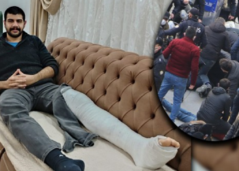 Gözaltına alınırken ayağı kırılan öğrenci: Kırıldıktan sonra basmaya devam ettiler