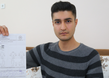 Kışlada işkence: Vücudunda sigara söndürüldü