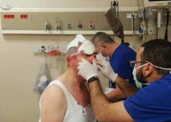 Selçuk Özdağ’a saldırıyla ilgili 2 kişi gözaltına alındı