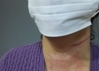 Şırnak’ta kadını darp eden korucular serbest