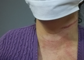 Evi korucular tarafından basılan kadın darp edildi