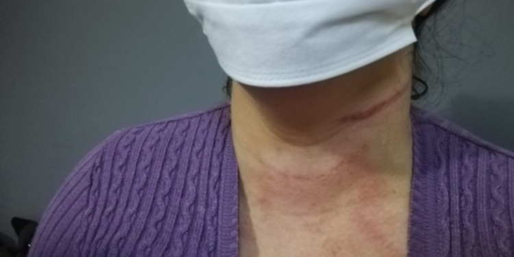 Evi korucular tarafından basılan kadın darp edildi Evi korucular tarafından basılan kadın darp edildi