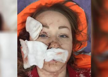 Ukraynalı kadına falçata ile saldıran koca tutuklandı