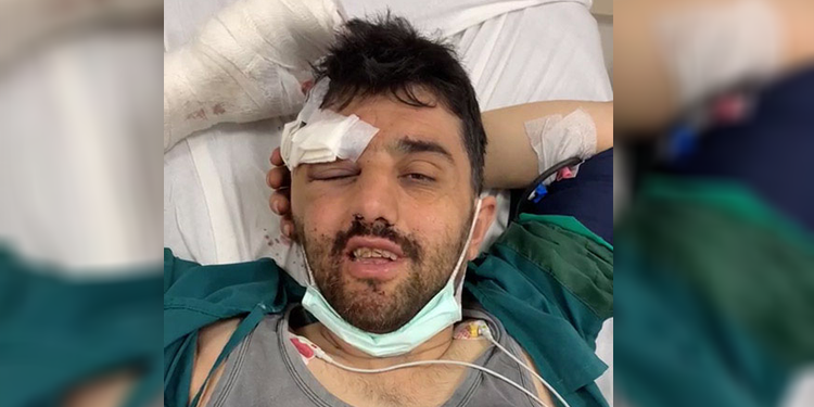 Madendeki göçükte bir işçi yaralanandı Madendeki göçükte bir işçi yaralanandı