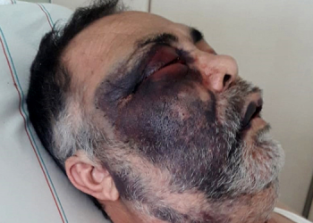 ‘Evde iyileştiririm dediğim kocamı, ellerimle toprağa verdim’