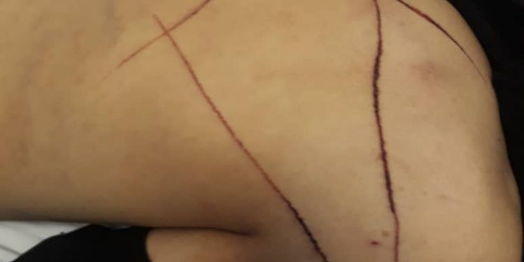 Sınırda kolberlere işkence: Bir kişi yaşamını yitirdi