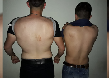 Iğdır’da bekçi ve polis şiddeti