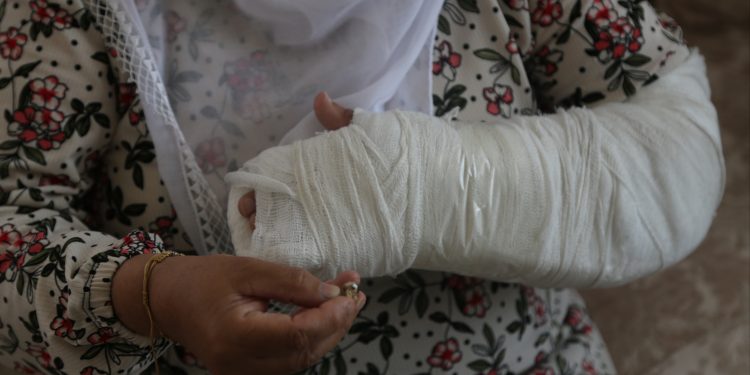 3 dişi ve kolu kırılan Demir: Polis yalan söylüyor