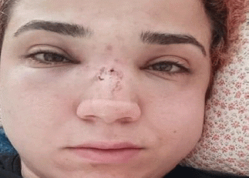 Kadın işçiye süpürgeli saldırı iddiası