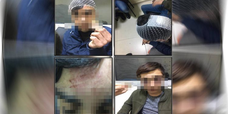 Çocuklara yapılan işkenceye takipsizlik Çocuklara yapılan işkenceye takipsizlik