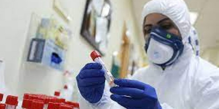 Coronadan 66 yeni ölüm Coronadan 66 yeni ölüm