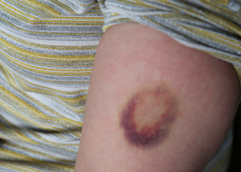 Van Adliyesi’nde kadına şiddet