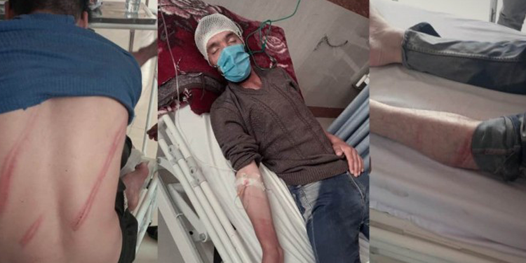 İran sınırında kolberlere ağır işkence İran sınırında kolberlere ağır işkence