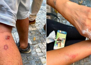 TGC’den polis şiddetine kınama