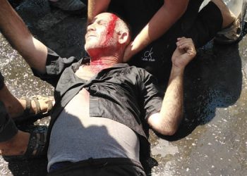 Çiftçilere müdahale: 2 yaralı, 7 gözaltı