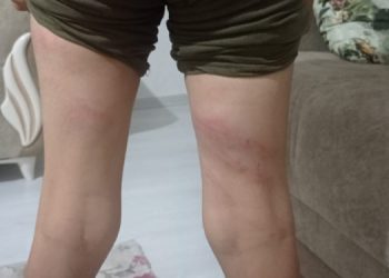 Komşunun 11 yaşındaki çocuğuna işkence yaptı!