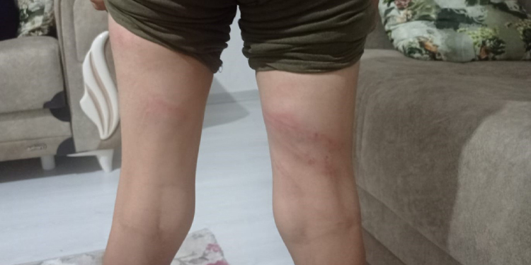 Komşunun 11 yaşındaki çocuğuna işkence yaptı! Komşunun 11 yaşındaki çocuğuna işkence yaptı!