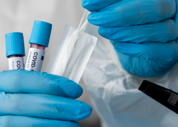 Yoğun bakımlar alarm veriyor: Bazı yerlerde yüzde 100’e yakın