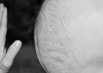 Türkiye obezitede Avrupa’da 1., dünyada 4. sırada