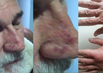 EDS Genel Sekreteri Ergül: Gözaltı değil bu bir işkence