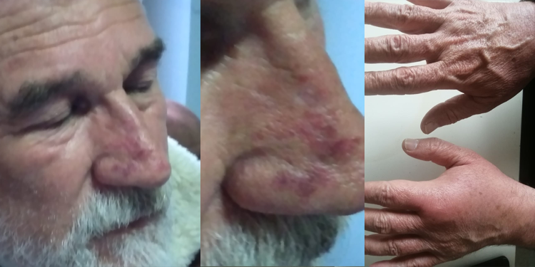 EDS Genel Sekreteri Ergül: Gözaltı değil bu bir işkence EDS Genel Sekreteri Ergül: Gözaltı değil bu bir işkence