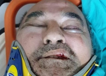 Gazeteci Ergün Poyraz saldırıya uğradı