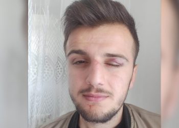 Bingöl’de polisten şiddet gören genç: Neden ülkücü işareti yapmıyorsun!