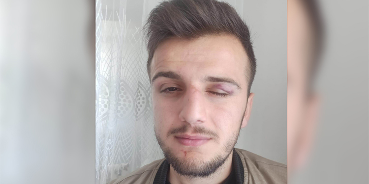 Bingöl’deki polis işkencesi Meclis gündemine taşındı