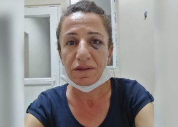 Köpekle işkence eden polis hakkında ‘basit yaralama’dan dava