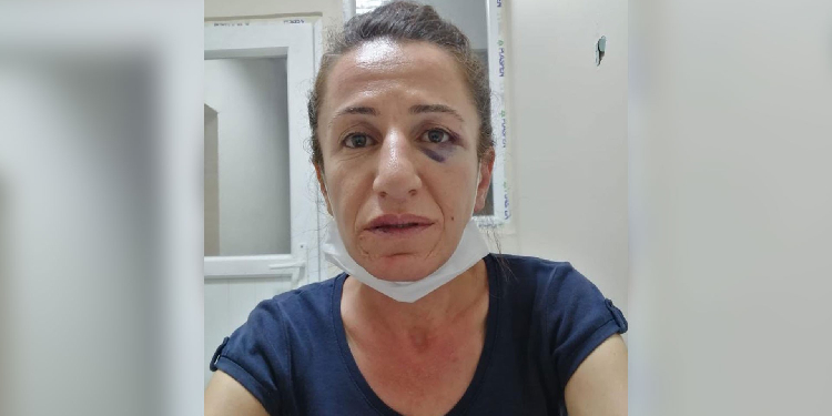 Köpekle işkence eden polis hakkında ‘basit yaralama’dan dava Köpekle işkence eden polis hakkında ‘basit yaralama’dan dava