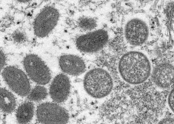 Rusya’da ilk maymun çiçeği vakası görüldü