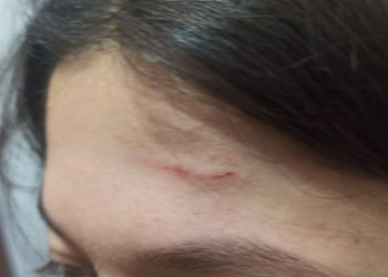 ÖGK üyesi Polat’a polis şiddeti