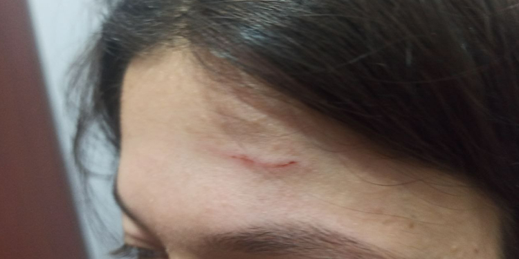 ÖGK üyesi Polat’a polis şiddeti ÖGK üyesi Polat’a polis şiddeti