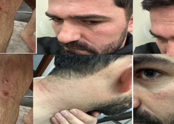 Polis kontrol noktasında avukata şiddet