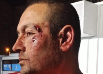 ÇHD: Antakya’da polis 3 kişiye işkence yaptı