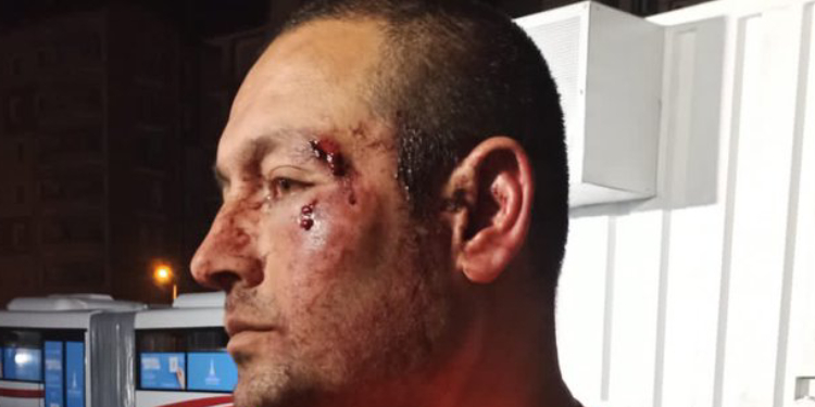 ÇHD: Antakya’da polis 3 kişiye işkence yaptı ÇHD: Antakya’da polis 3 kişiye işkence yaptı