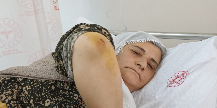 DİSKİ personelinin darp ettiği kadın yaralandı DİSKİ personelinin darp ettiği kadın yaralandı