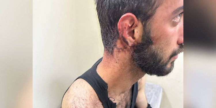 Yüksekova’da darp edilerek gözaltına alınan gençler serbest Yüksekova’da darp edilerek gözaltına alınan gençler serbest