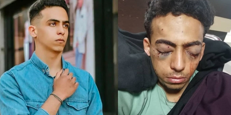 İran rejimi, yaralı Kürdü tutukladı İran rejimi, yaralı Kürdü tutukladı