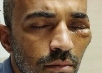 Ameliyat olması gereken Nia’dan kamuoyuna çağrı