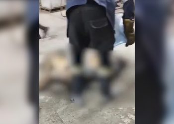 Yanan işçiye tedavi şekli: Damacana su döküldü