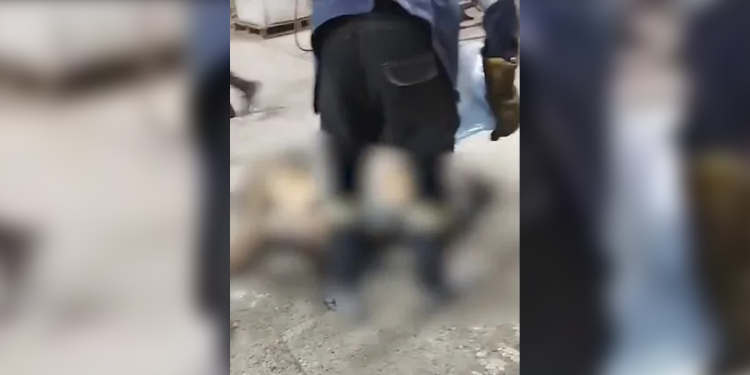 Yanan işçiye tedavi şekli: Damacana su döküldü Yanan işçiye tedavi şekli: Damacana su döküldü