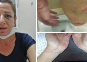 ‘Köpekli işkence’ davasında olay işkence olarak görülmedi