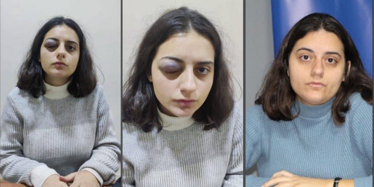 HEDEP Gençlik Meclisi Sözcüsü’ne polis şiddeti