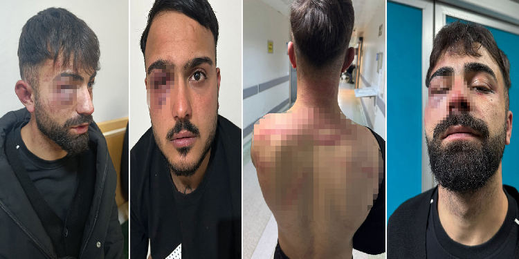 Newroz sonra ev baskınında işkence: Polisler hakkında suç duyurusu