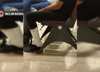 Darp izleri ve alçılı ayağa rağmen ‘darp yoktur’ raporu